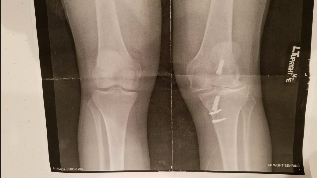 Resized_20170415_230405